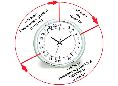 2018 Stroke Guidelines Extend The Thrombectomy Window To 24 Hours In 2018 Stroke Guidelines Extend The Thrombectomy Window To 24 Hours In