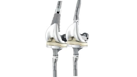 Knee Replacement Surgery Total Knee Depuy Synthes